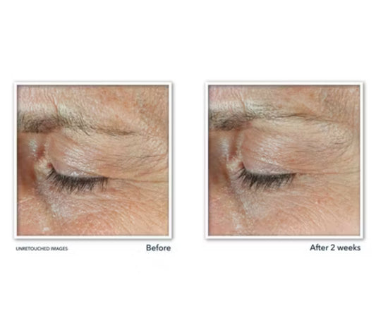 RoC Derm Correxion Dual Eye Cream 0.68 fl oz