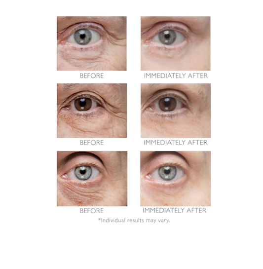 Peter Thomas Roth Instant FIRMx® Eye Temporary Eye Tightener 30 ml