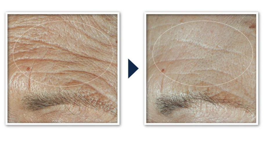 RoC Face & Neck Anti-Aging Moisturizer Firming Cream for Crepey Skin 48 gr